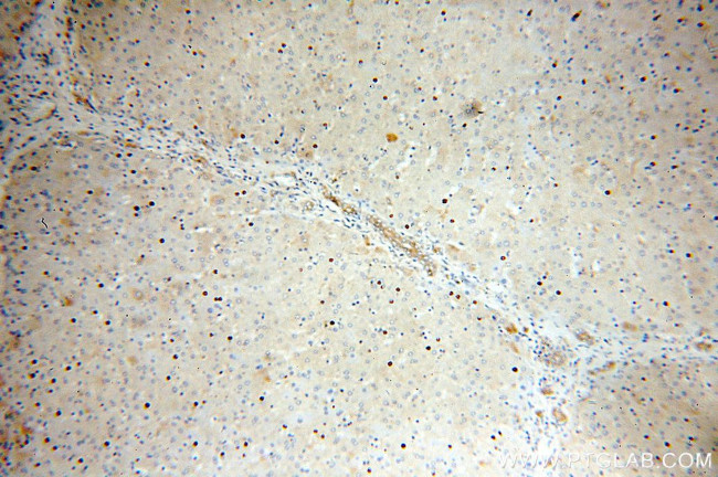 DLC1 Antibody in Immunohistochemistry (Paraffin) (IHC (P))