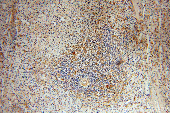 DLC1 Antibody in Immunohistochemistry (Paraffin) (IHC (P))