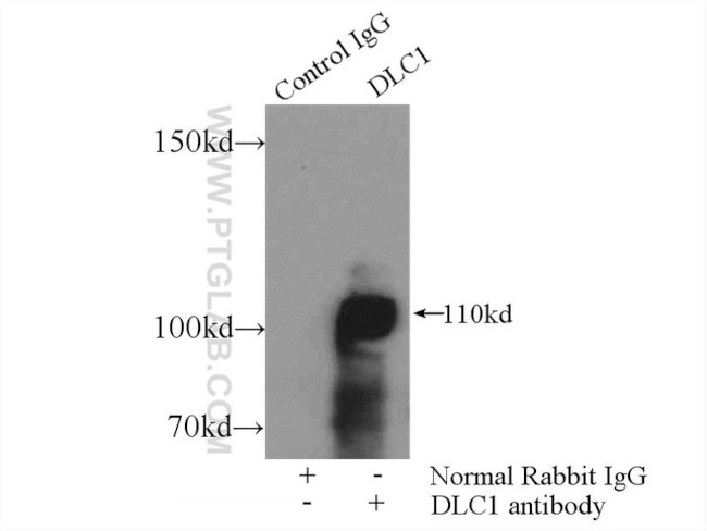 DLC1 Antibody in Immunoprecipitation (IP)