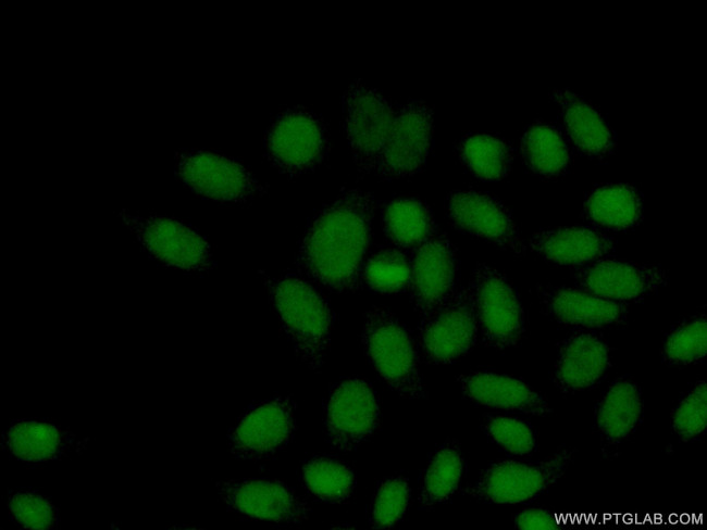 RPP25 Antibody in Immunocytochemistry (ICC/IF)