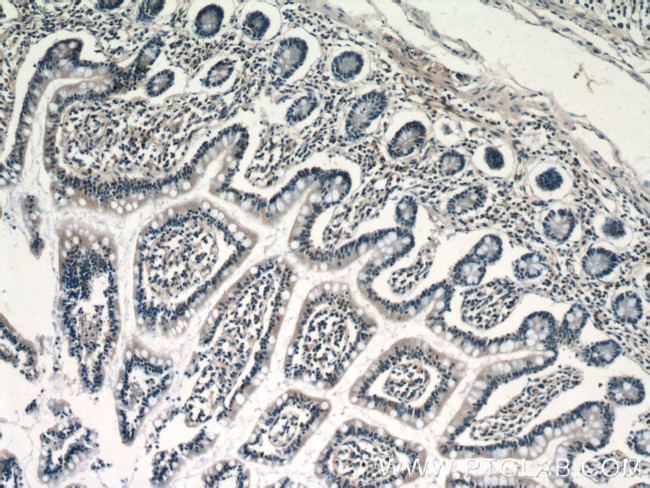 RPP25 Antibody in Immunohistochemistry (Paraffin) (IHC (P))