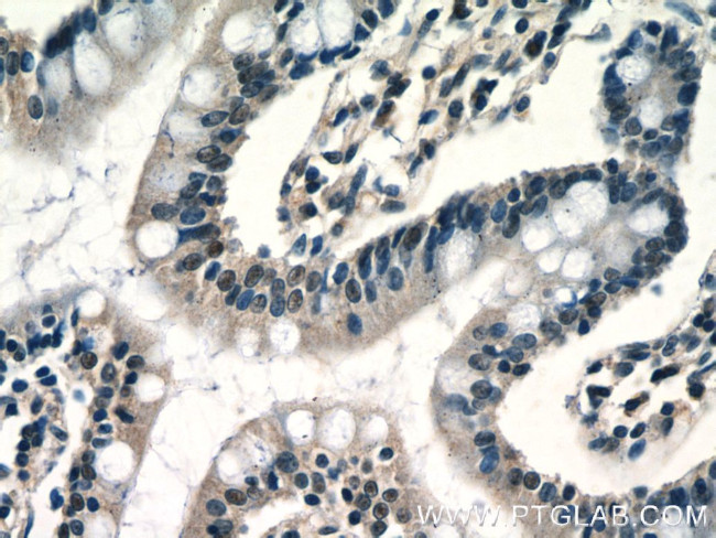 RPP25 Antibody in Immunohistochemistry (Paraffin) (IHC (P))