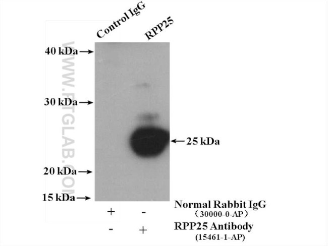 RPP25 Antibody in Immunoprecipitation (IP)