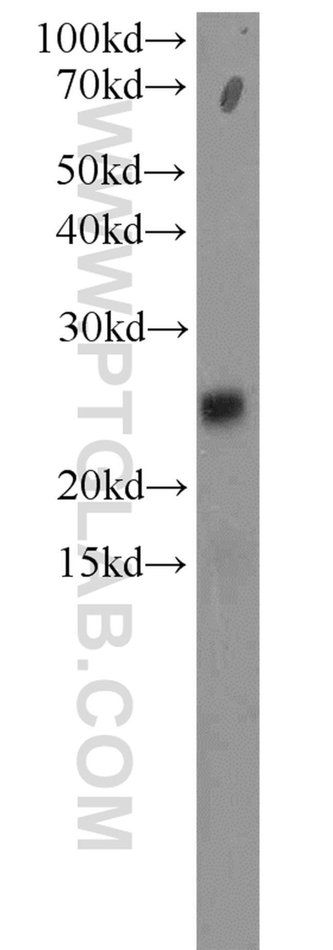 RPP25 Antibody in Western Blot (WB)