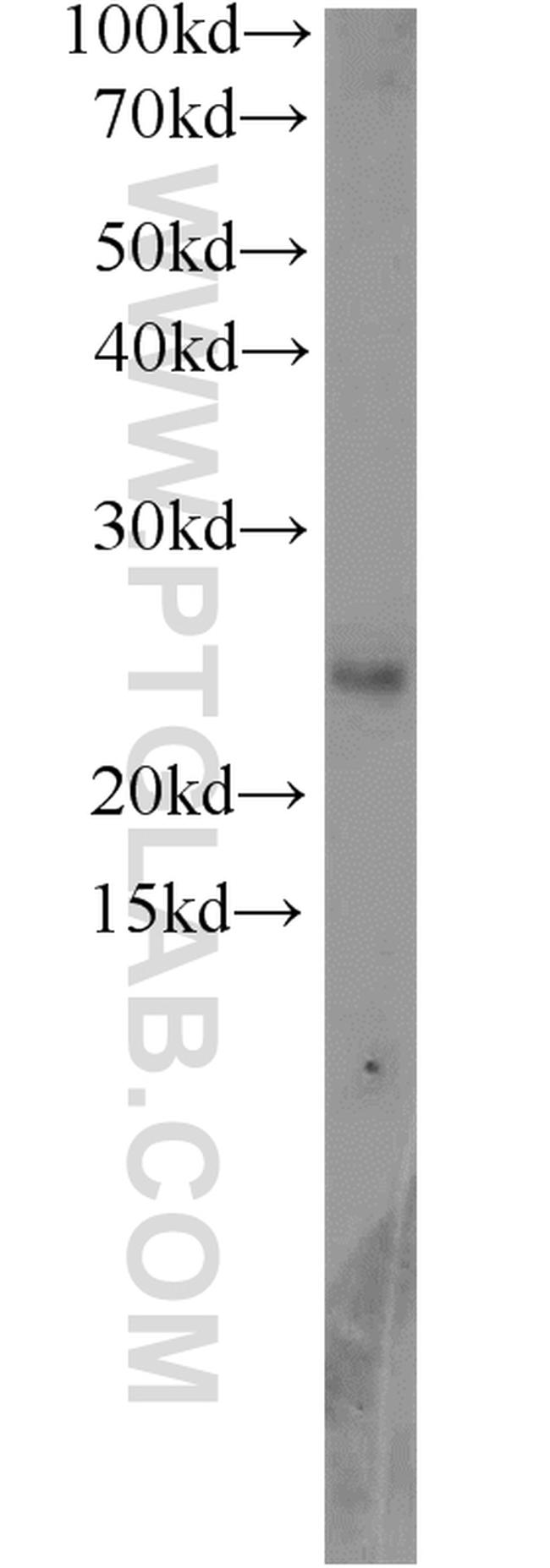 RPP25 Antibody in Western Blot (WB)