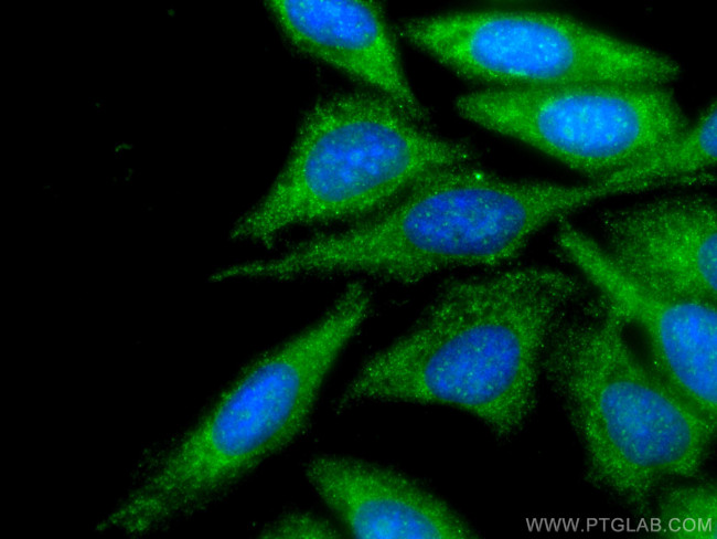 MAPKAP1 Antibody in Immunocytochemistry (ICC/IF)