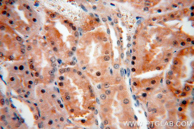 MAPKAP1 Antibody in Immunohistochemistry (Paraffin) (IHC (P))