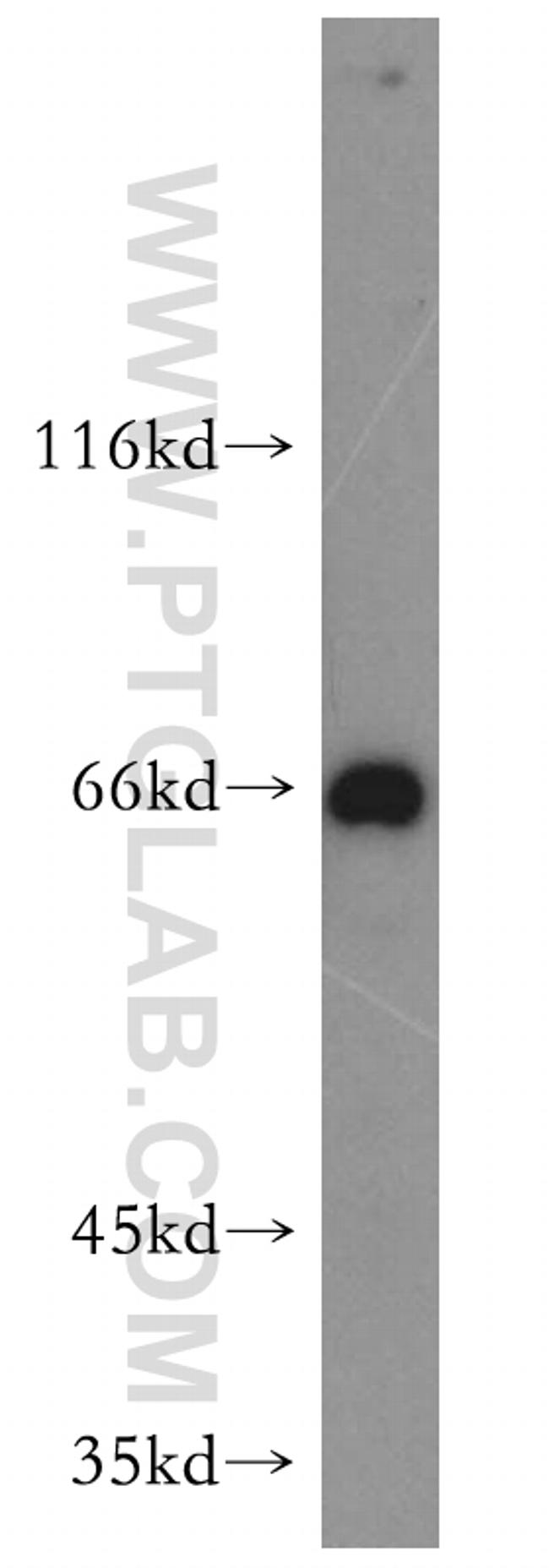 MAPKAP1 Antibody in Western Blot (WB)