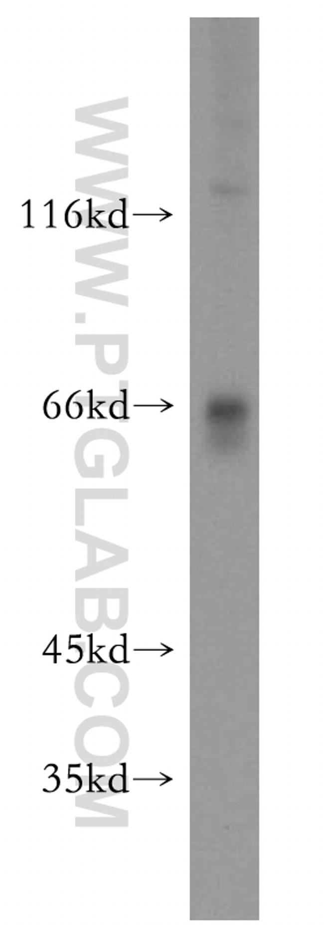 MAPKAP1 Antibody in Western Blot (WB)