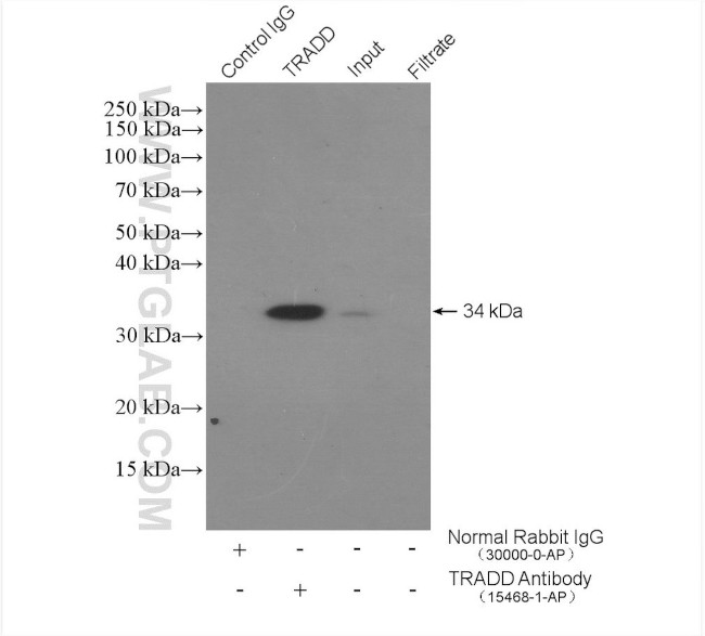 TRADD Antibody in Immunoprecipitation (IP)