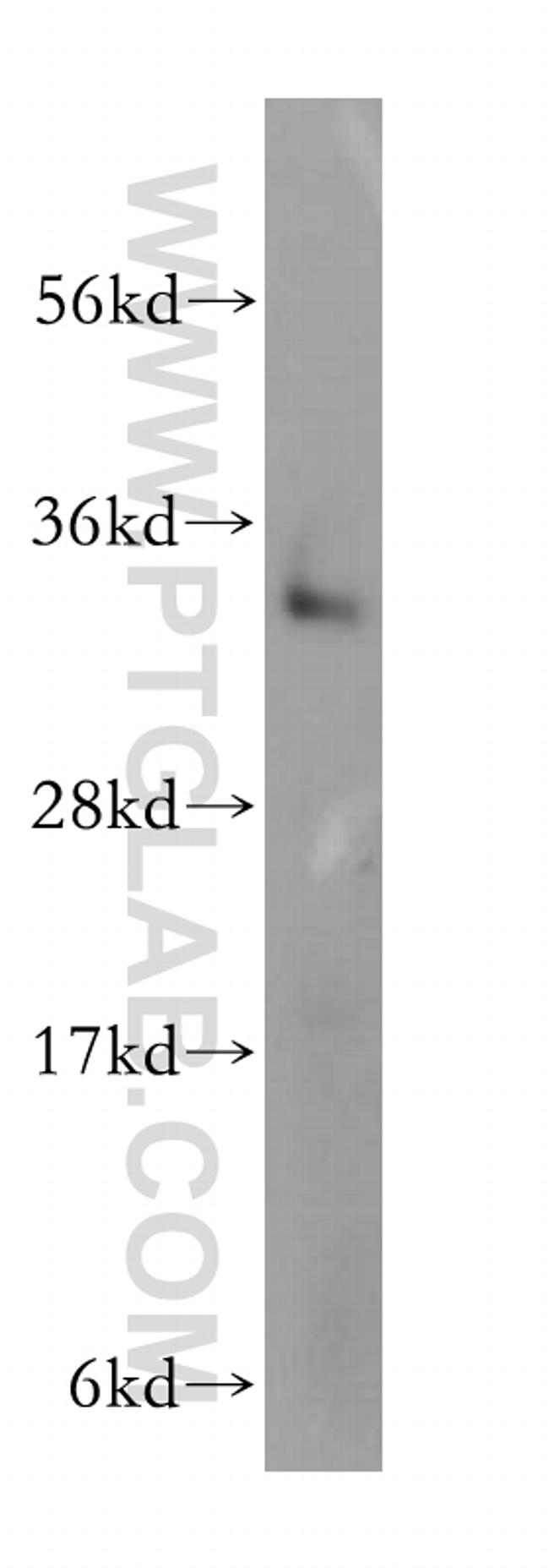 TRADD Antibody in Western Blot (WB)