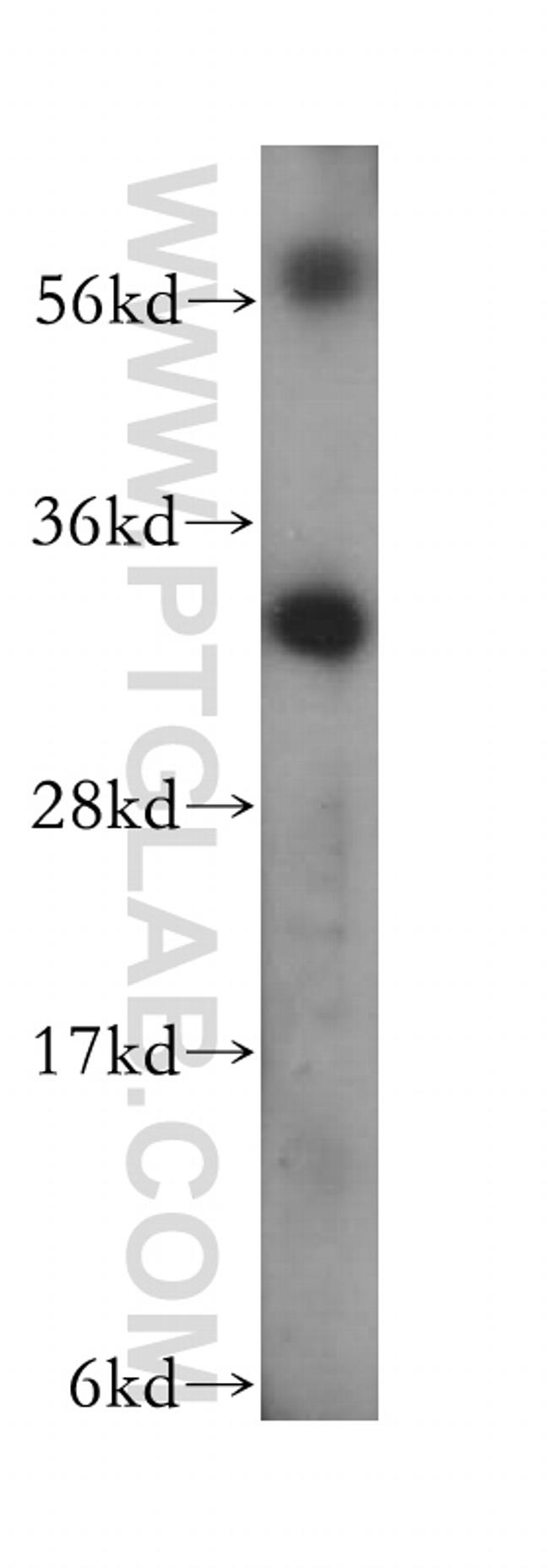 TRADD Antibody in Western Blot (WB)