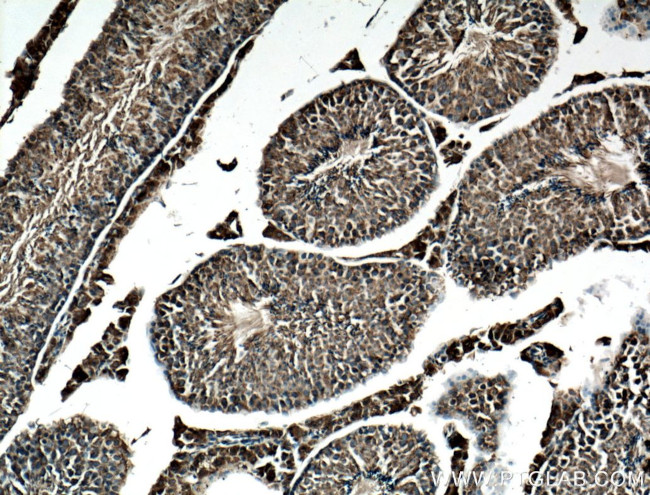 CYB5B Antibody in Immunohistochemistry (Paraffin) (IHC (P))