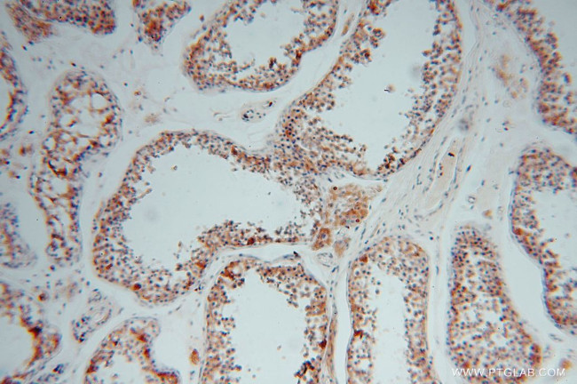 CYB5B Antibody in Immunohistochemistry (Paraffin) (IHC (P))