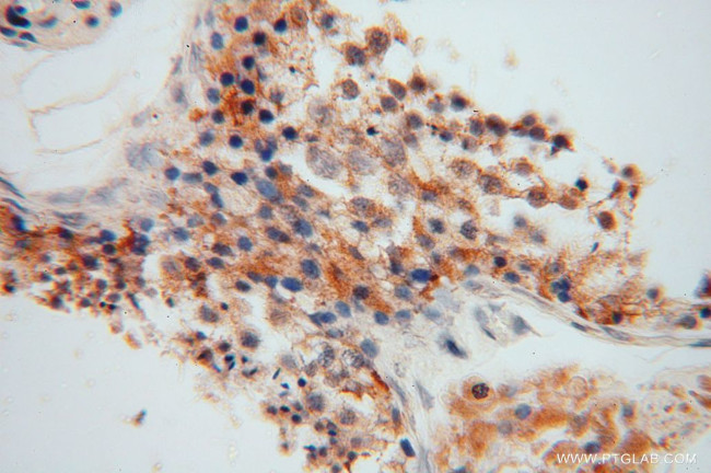 CYB5B Antibody in Immunohistochemistry (Paraffin) (IHC (P))