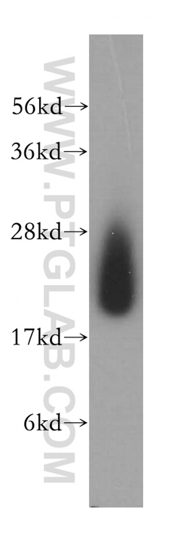 CYB5B Antibody in Western Blot (WB)