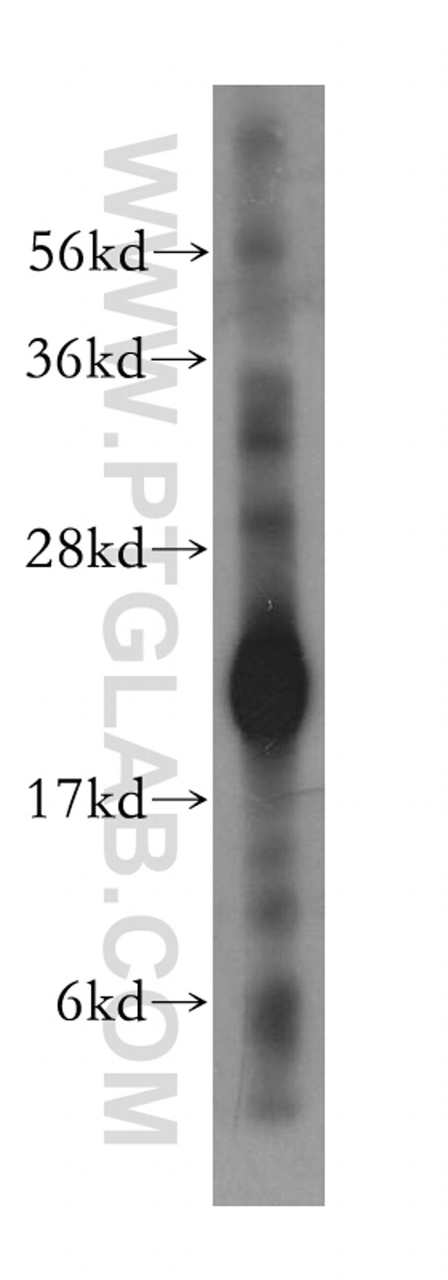 CYB5B Antibody in Western Blot (WB)