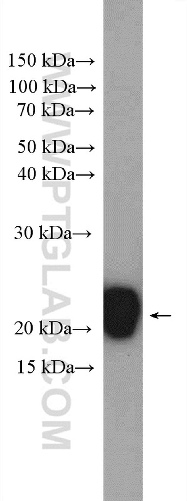 CYB5B Antibody in Western Blot (WB)