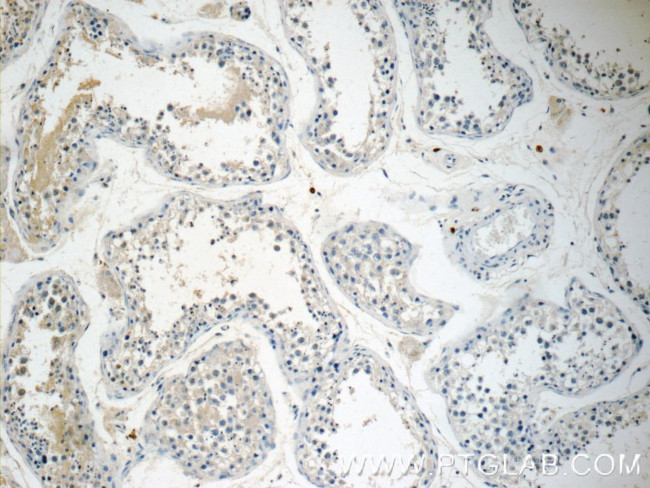 ALKBH7 Antibody in Immunohistochemistry (Paraffin) (IHC (P))