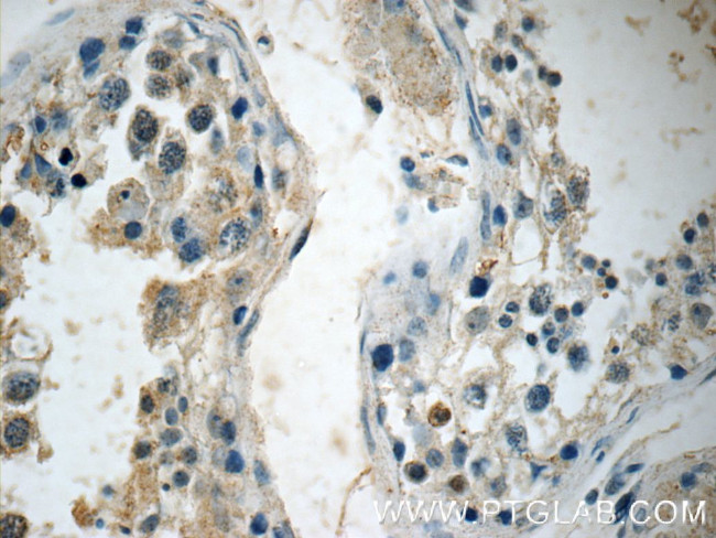 ALKBH7 Antibody in Immunohistochemistry (Paraffin) (IHC (P))