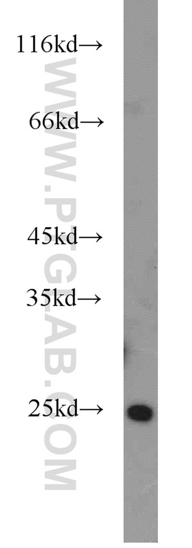 ALKBH7 Antibody in Western Blot (WB)