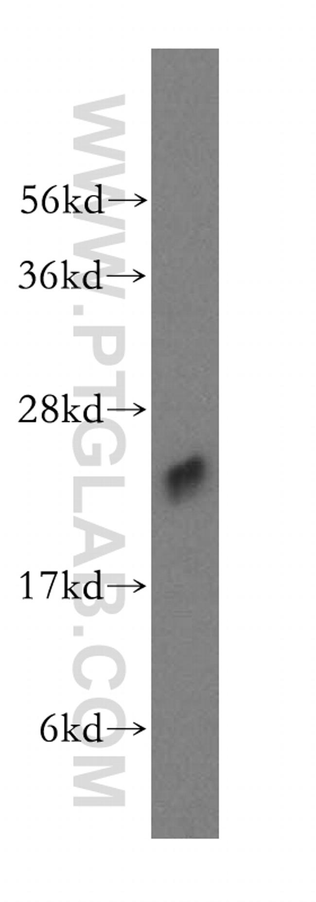 ALKBH7 Antibody in Western Blot (WB)