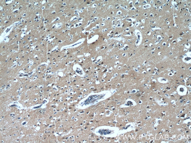 LIMD2 Antibody in Immunohistochemistry (Paraffin) (IHC (P))