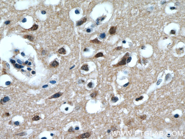 LIMD2 Antibody in Immunohistochemistry (Paraffin) (IHC (P))