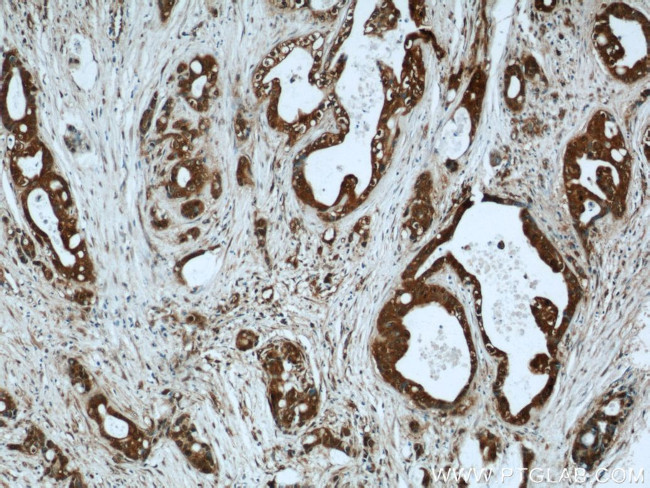 LIMD2 Antibody in Immunohistochemistry (Paraffin) (IHC (P))