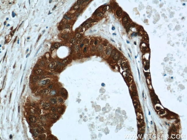 LIMD2 Antibody in Immunohistochemistry (Paraffin) (IHC (P))