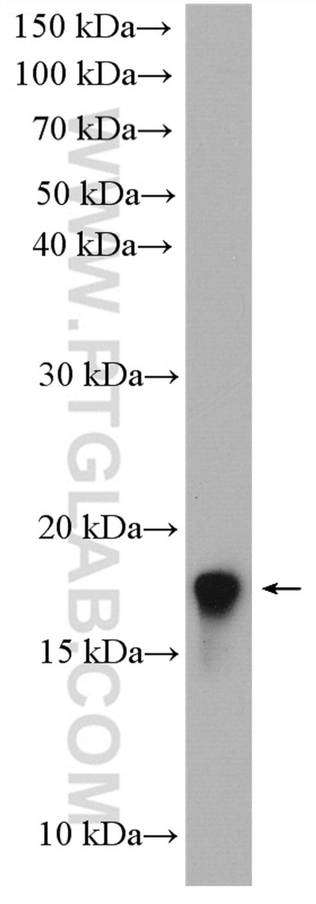 LIMD2 Antibody in Western Blot (WB)