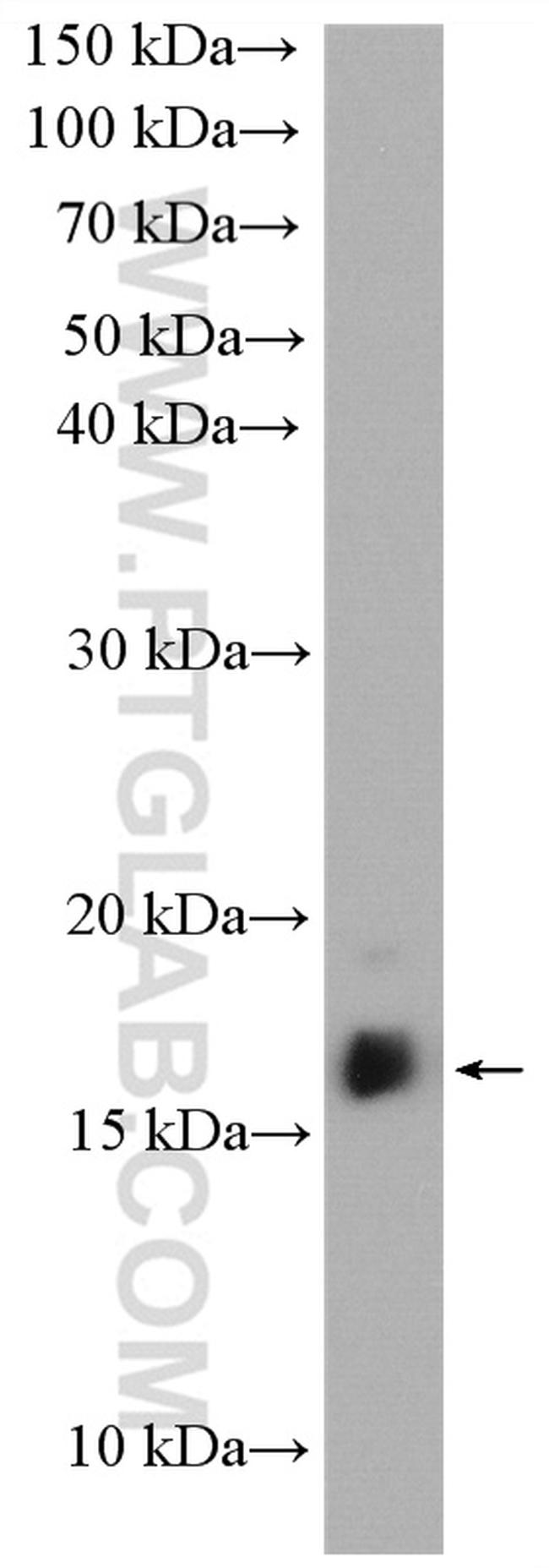 LIMD2 Antibody in Western Blot (WB)
