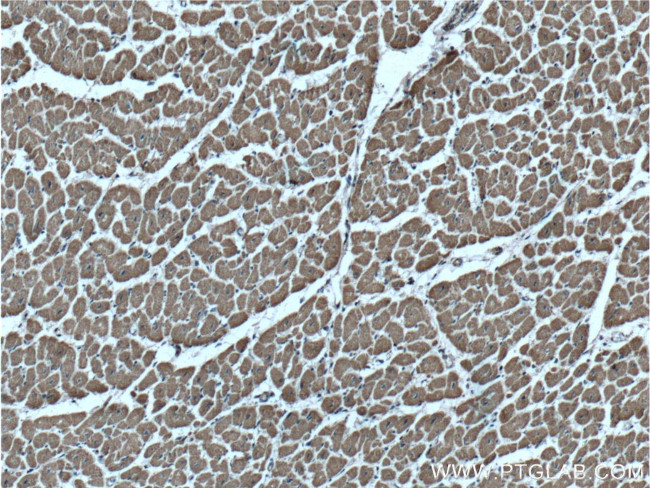 VPS24 Antibody in Immunohistochemistry (Paraffin) (IHC (P))