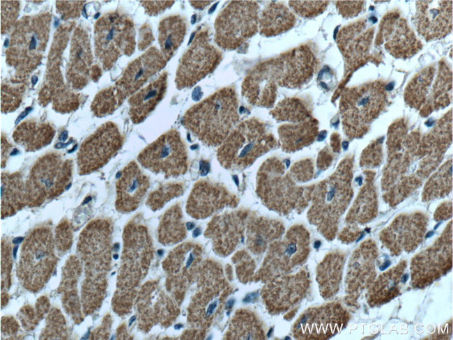 VPS24 Antibody in Immunohistochemistry (Paraffin) (IHC (P))