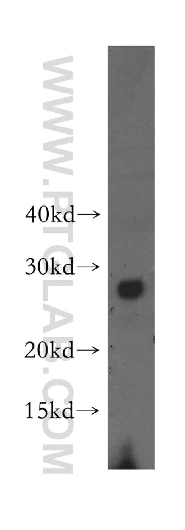 VPS24 Antibody in Western Blot (WB)