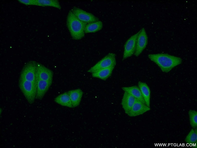 VPS24 Antibody in Immunocytochemistry (ICC/IF)