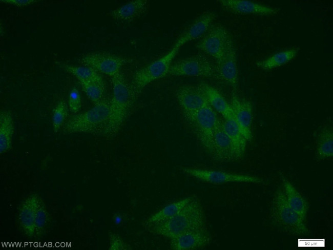 MAGEA11 Antibody in Immunocytochemistry (ICC/IF)