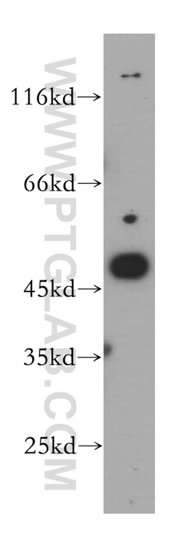 MAGEA11 Antibody in Western Blot (WB)