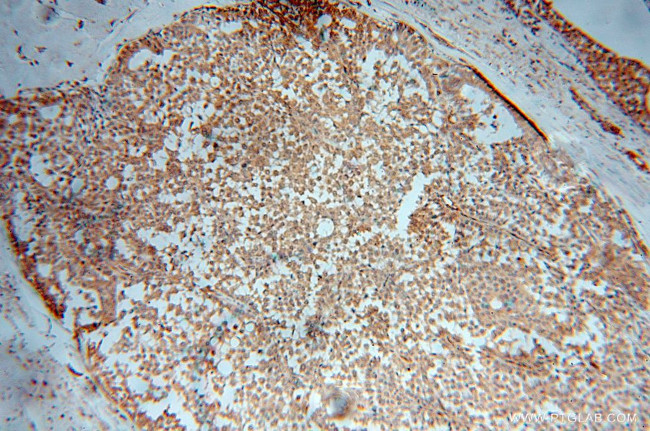 UBE2D4 Antibody in Immunohistochemistry (Paraffin) (IHC (P))