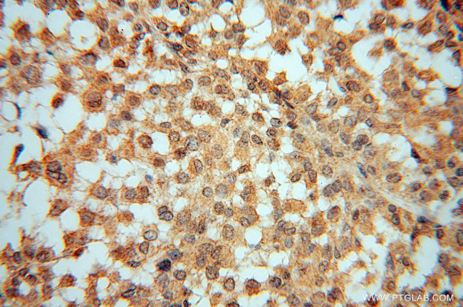 UBE2D4 Antibody in Immunohistochemistry (Paraffin) (IHC (P))