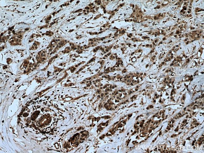 UBE2D4 Antibody in Immunohistochemistry (Paraffin) (IHC (P))