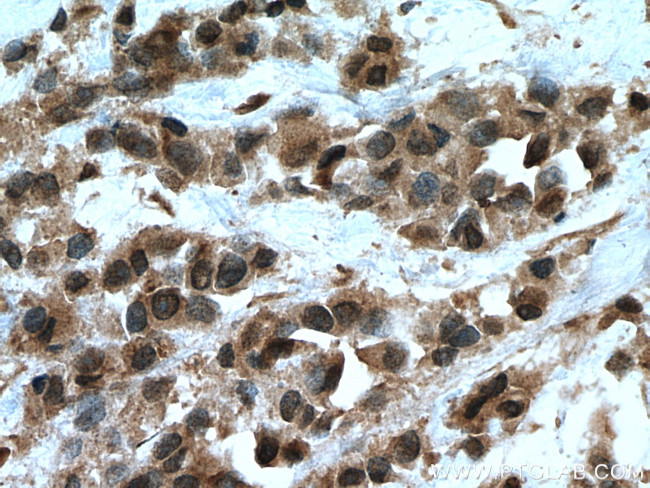 UBE2D4 Antibody in Immunohistochemistry (Paraffin) (IHC (P))