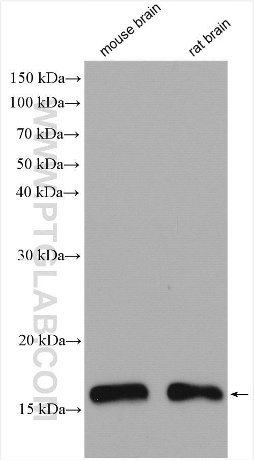 UBE2D4 Antibody in Western Blot (WB)