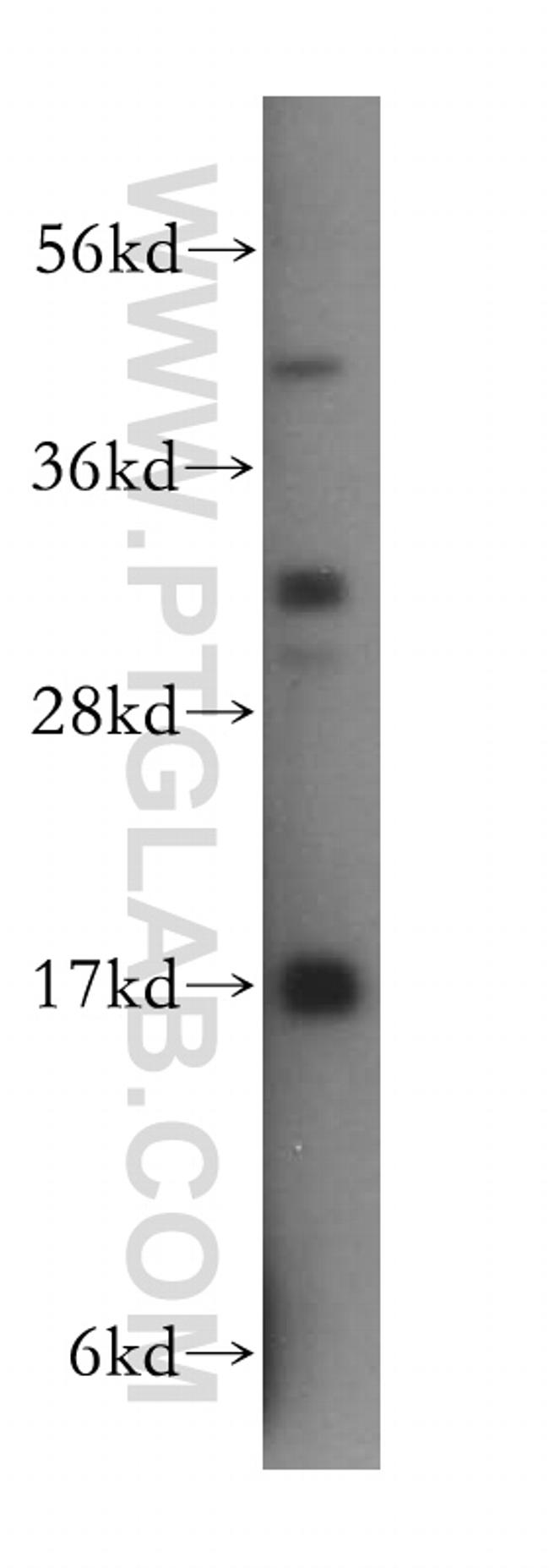 UBE2D4 Antibody in Western Blot (WB)