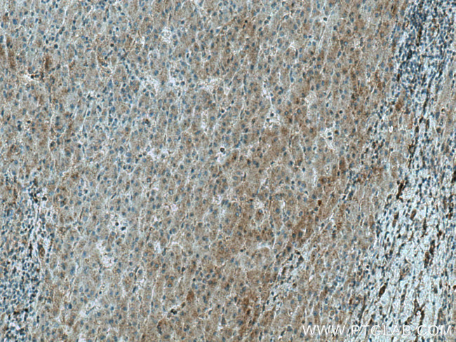 ADK Antibody in Immunohistochemistry (Paraffin) (IHC (P))