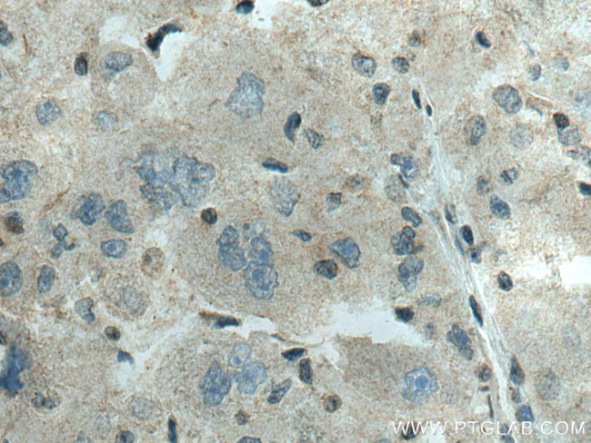 ADK Antibody in Immunohistochemistry (Paraffin) (IHC (P))