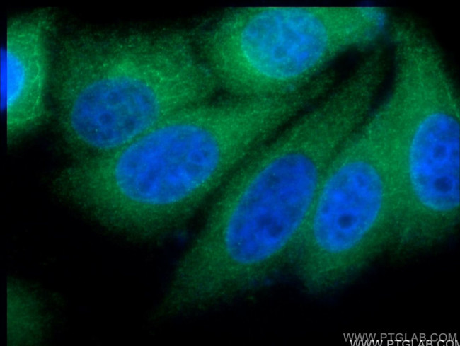 VPS28 Antibody in Immunocytochemistry (ICC/IF)