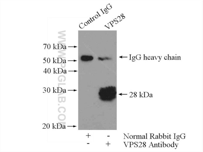 VPS28 Antibody in Immunoprecipitation (IP)