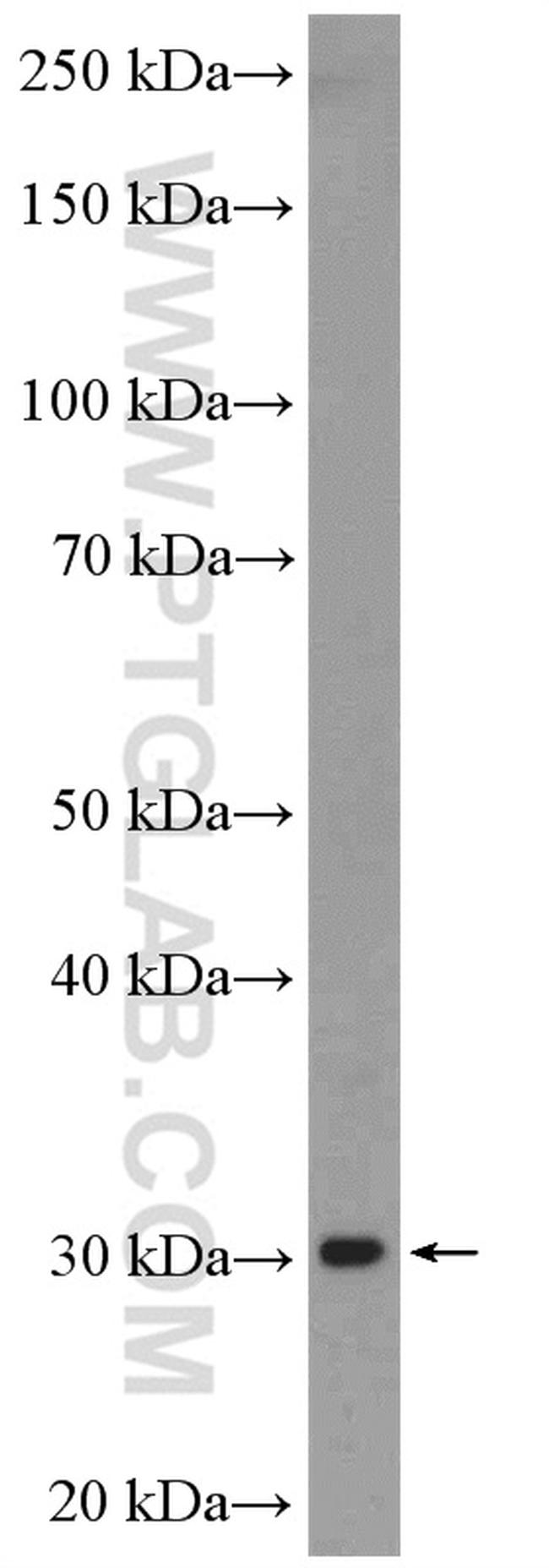 VPS28 Antibody in Western Blot (WB)