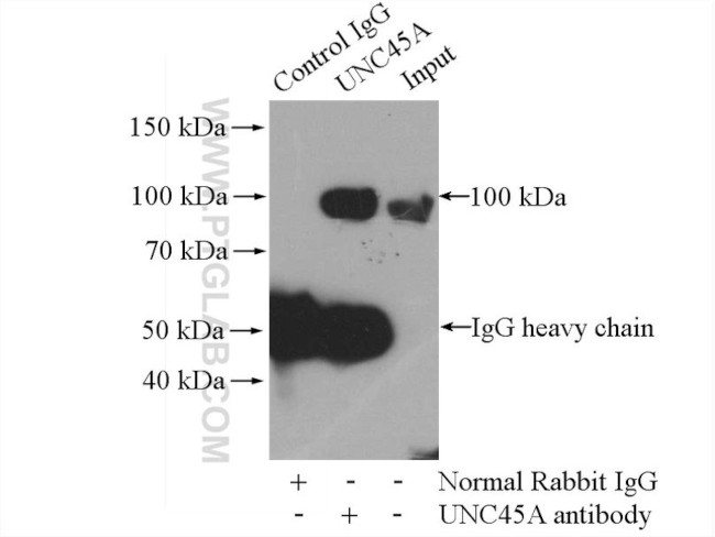 UNC45A Antibody in Immunoprecipitation (IP)